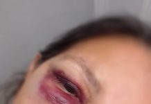 Idosa é espancada durante assalto no Cruzeiro Veja o Vídeo