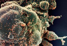 Covid-19: Brasil tem novo recorde e chega a 32.548 mortes e 584.016 casos