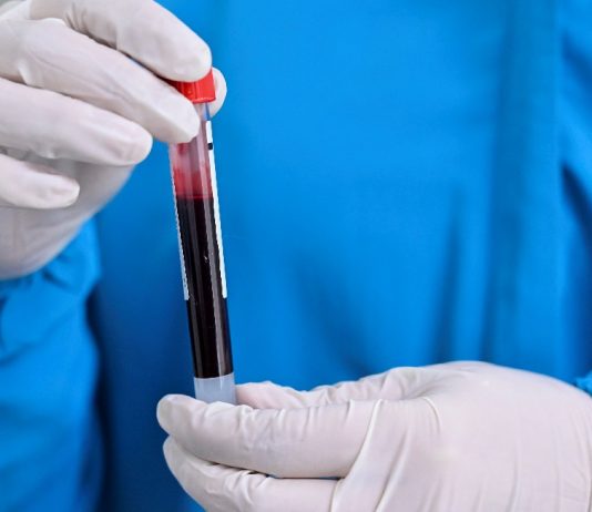 Primeiro caso de reinfecção pela covid-19 no mundo é confirmado