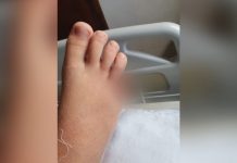 Menino perdeu dedo em lago de GO com histórico de ataques de piranhas