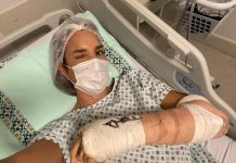 Ivete apresenta programa com braço enfaixado e tipoia após acidente