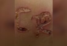 Absurdo -Homem é preso por marcar iniciais do nome em esposa com ferro quente